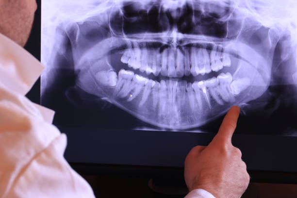 Best Broken or Cracked Tooth Emergency Dentist in Catawba, SC