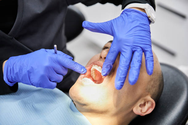 Best Emergency Dentist for Knocked-Out Tooth in Catawba, SC